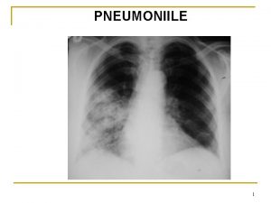 PNEUMONIILE 1 Complicaiile pneumoniilor n Frecvente q n