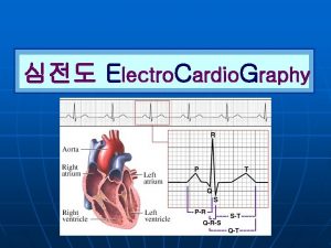 Electro Cardio Graphy n Cardiac anatomy and physiology