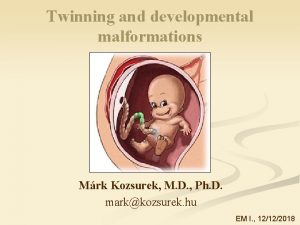 Twinning and developmental malformations Mrk Kozsurek M D