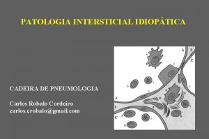 PATOLOGIA INTERSTICIAL IDIOPTICA CADEIRA DE PNEUMOLOGIA Carlos Robalo