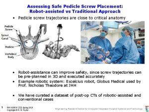 Assessing Safe Pedicle Screw Placement Robotassisted vs Traditional