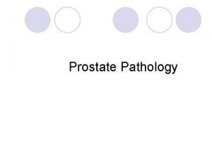 Prostate Pathology Prostate Pathology l Prostate weighs 20