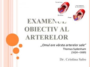 EXAMENUL OBIECTIV AL ARTERELOR Omul are vrsta arterelor