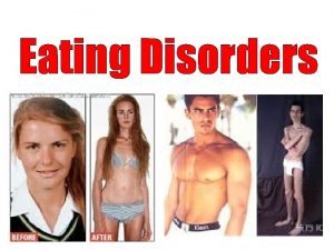 Eating Disorders Understanding Eating Disorders PsychologicalEmotional DisordersMental Health