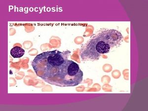 Phagocytosis Macrophage PMNLs Plasma cells lymphocyte inflammation seen