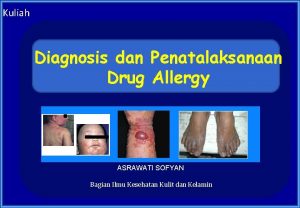 Kuliah Diagnosis dan Penatalaksanaan Drug Allergy ASRAWATI SOFYAN