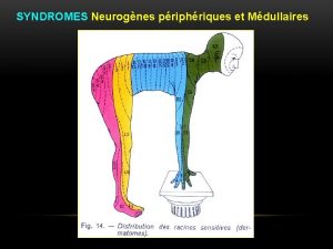 SYNDROMES Neurognes priphriques et Mdullaires Atteinte neurogne priphrique