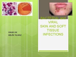 ONUR OK HELN YILMAZ BACTERIAL and VIRAL SKIN