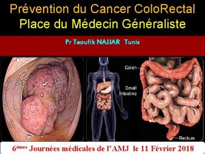 Prvention du Cancer Colo Rectal Place du Mdecin