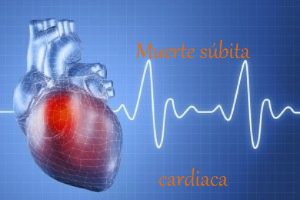 Muerte sbita cardiaca Probabilidad Total de morir Por