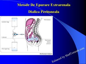 Metode De Epurare Extrarenala Dializa Peritoneala e M