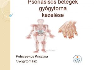 Psoriasisos betegek gygytorna kezelse Petricsevics Krisztina Gygytornsz Dr