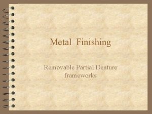Metal Finishing Removable Partial Denture frameworks 1 Definition