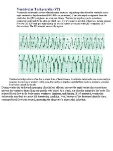 Ventricular Tachycardia VT Ventricular tachycardia occurs when electrical