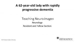 A 62 yearold lady with rapidly progressive dementia