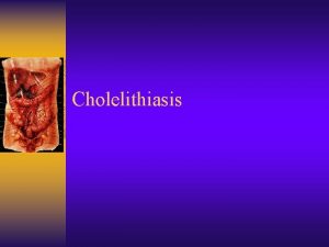 Cholelithiasis A Cause For Pain Background Presence of