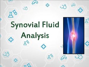 Definition Alternative names Joint fluid analysis Joint fluid
