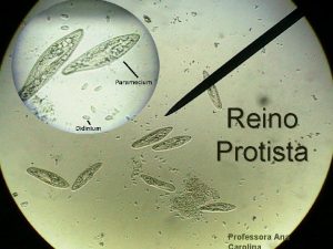 Reino Protista Professora Ana Reino Protista v Seres