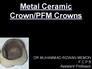 Metal Ceramic CrownPFM Crowns DR MUHAMMAD RIZWAN MEMON