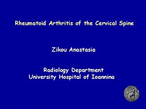 Rheumatoid Arthritis of the Cervical Spine Zikou Anastasia
