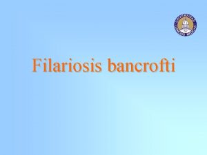 Filariosis bancrofti Filariosis bancrofti Infeccin producida por la