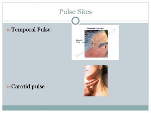 Pulse Sites Temporal Pulse Carotid pulse Pulse Sites