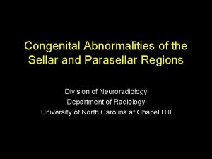 Congenital Abnormalities of the Sellar and Parasellar Regions