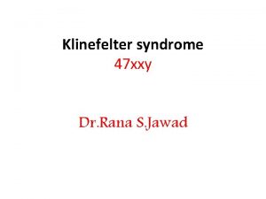 Klinefelter syndrome 47 xxy Dr Rana S Jawad