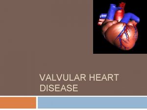 VALVULAR HEART DISEASE Key points Valvular heart disease