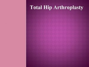 Total Hip Arthroplasty CONTENTS Hip joint anatomy What
