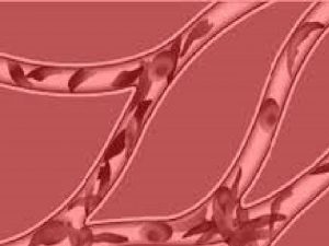 What is sickle cell Sickle cell disease refers