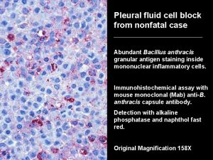 Pleural fluid cell block from nonfatal case Abundant