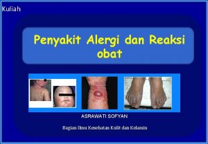 Kuliah Penyakit Alergi dan Reaksi obat ASRAWATI SOFYAN