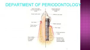 DEPARTMENT OF PERIODONTOLOGY 1 MDS in Periodontology as