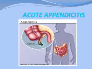 ACUTE APPENDICITIS ACUTE APPENDICITIS Appendicitis is defined as