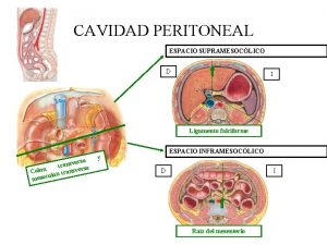 CAVIDAD PERITONEAL ESPACIO SUPRAMESOCLICO D I Ligamento falciforme