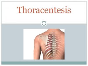 Thoracentesis ETIOLOGY OF PLEURAL EFFUSIONS The most common