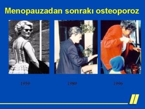 Menopauzadan sonrak osteoporoz 1959 1989 1996 Osteoporoz OP