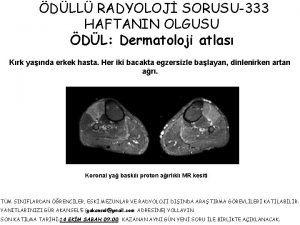 DLL RADYOLOJ SORUSU333 HAFTANIN OLGUSU DL Dermatoloji atlas