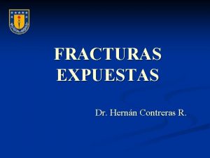 FRACTURAS EXPUESTAS Dr Hernn Contreras R FRACTURAS EXPUESTAS