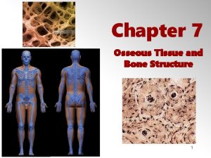 Chapter 7 Osseous Tissue and Bone Structure 1