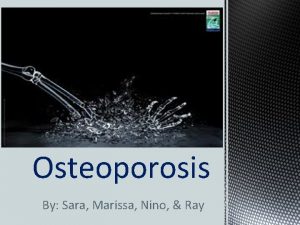 Osteoporosis By Sara Marissa Nino Ray Definition Osteoporosis