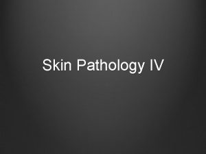 Skin Pathology IV Acne Vulgaris More severe in