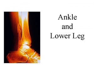 Ankle and Lower Leg Do Now What do