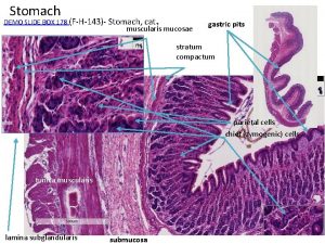 Stomach muscularis mucosae DEMO SLIDE BOX 178 FH143