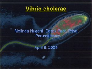 Vibrio cholerae Melinda Nugent Derek Park Priya Perumalsamy
