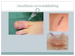 Anesthesie en wondsluiting Lokale anesthesie Lokaal plaatselijke verdoving