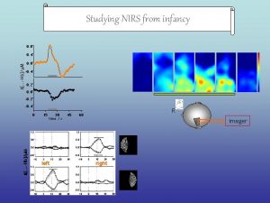 Studying NIRS from infancy 0 8 d HbM