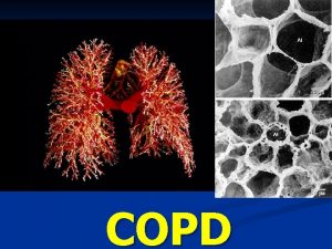 COPD Respiratory System 22 1 Figure Respiratory System