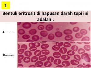 1 Bentuk eritrosit di hapusan darah tepi ini